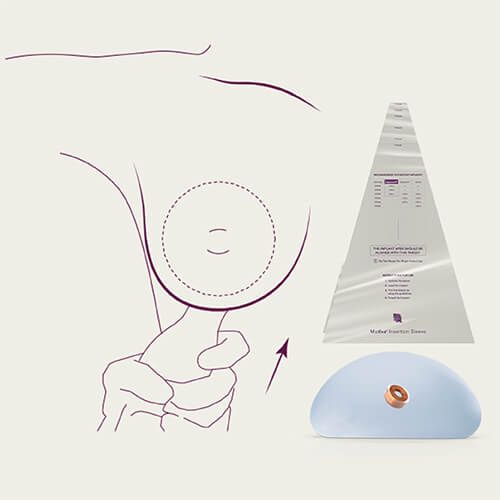 Motiva Sleve Ballon copy