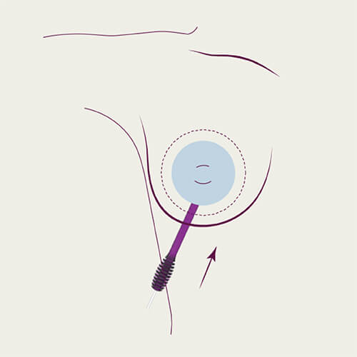 Motiva inflable Ballon copy